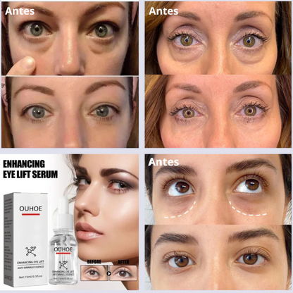 Serum quita Ojeras OUHOE