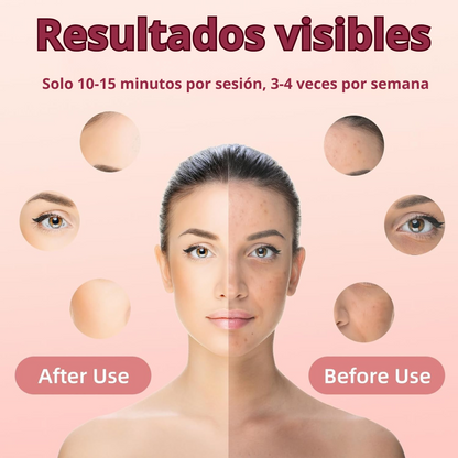 LumiSkin Pro™