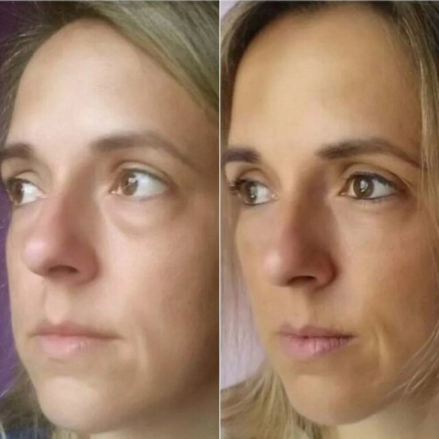 Serum quita Ojeras OUHOE