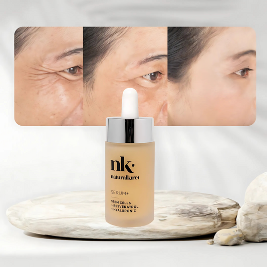 Serum NK+