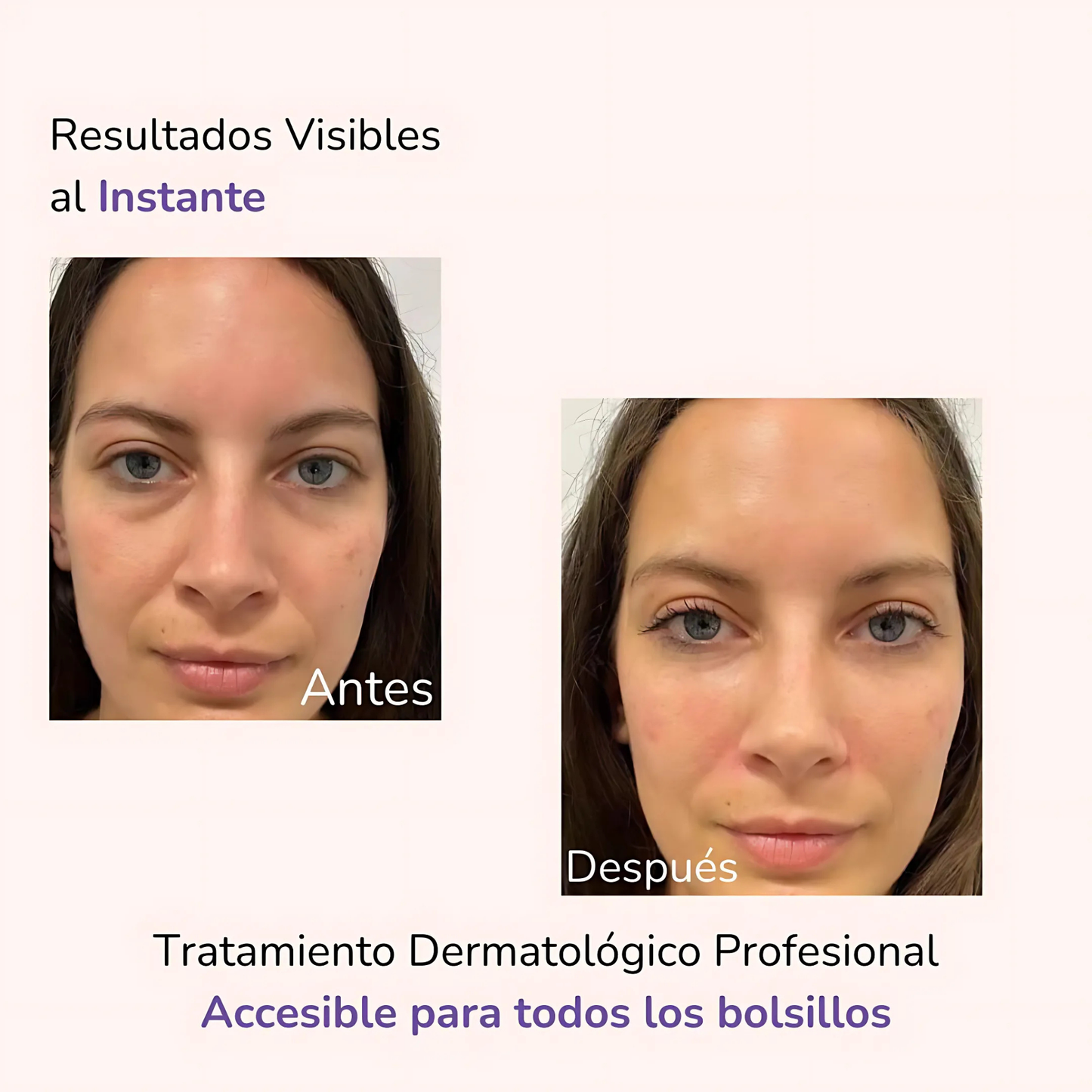 Serum quita Ojeras OUHOE