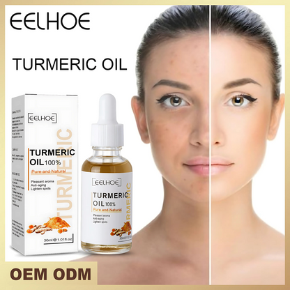 Aceite Esencial de Cúrcuma