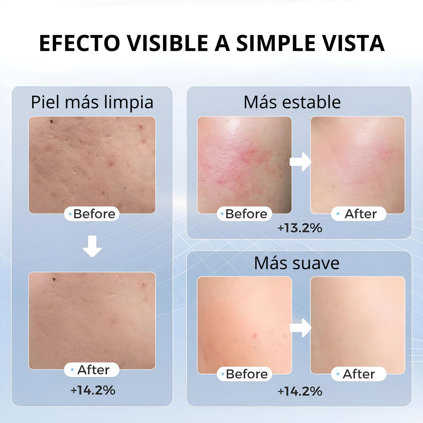 LumiSkin Pro™