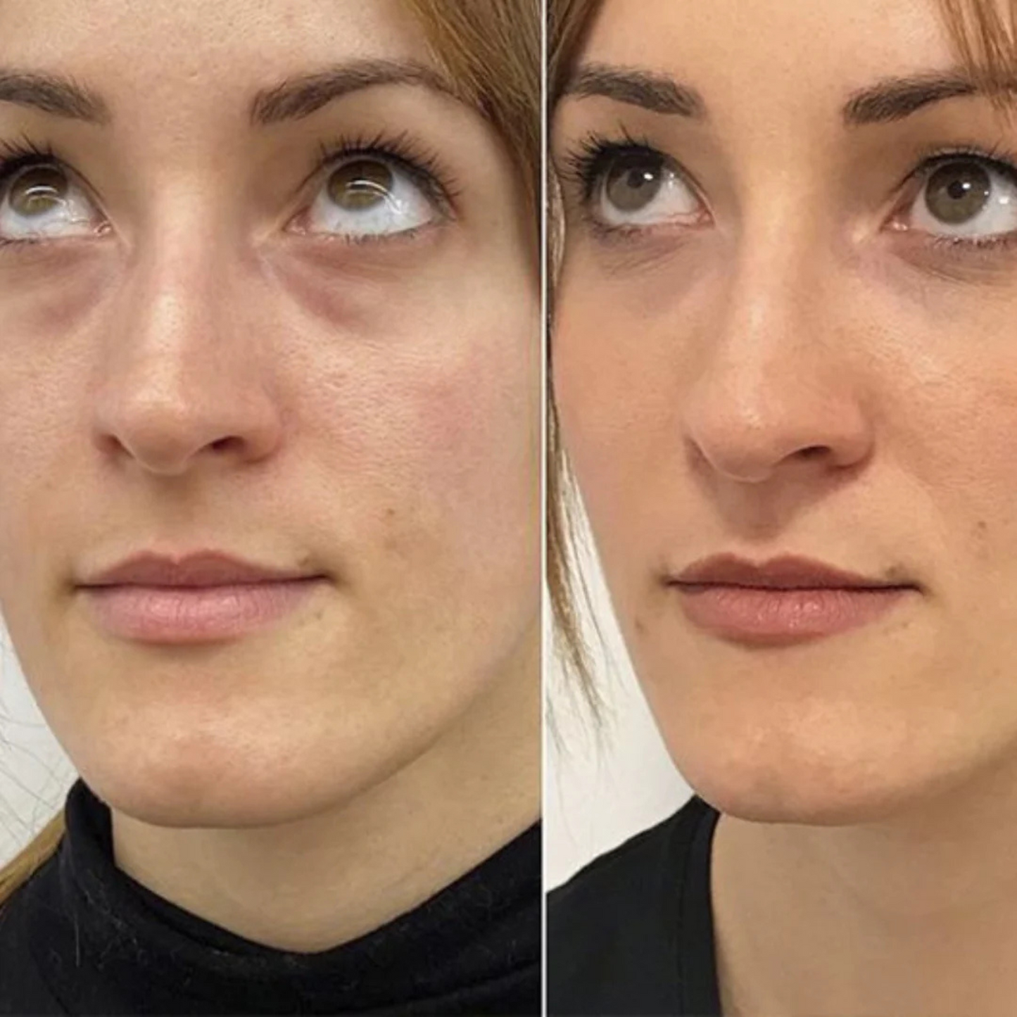 Serum quita Ojeras OUHOE